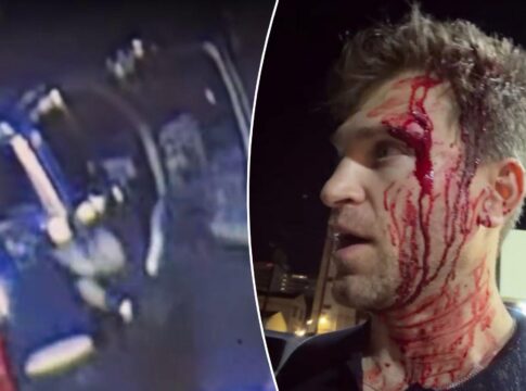 Featured image related to Bloodied ‘Pretty Little Liars’ star Keegan Allen robbed at gunpoint, knifepoint in attack outs
